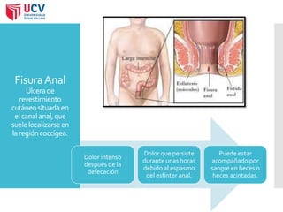 Fisura Anal 
Úlcera de 
revestimiento 
cutáneo situada en 
el canal anal, que 
suele localizarse en 
la región coccígea. 
Dolor intenso 
después de la 
defecación 
Dolor que persiste 
durante unas horas 
debido al espasmo 
del esfínter anal. 
Puede estar 
acompañado por 
sangre en heces o 
heces acintadas. 
 