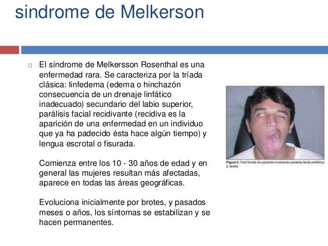 La depilación láser sobre la persona las revocaciones