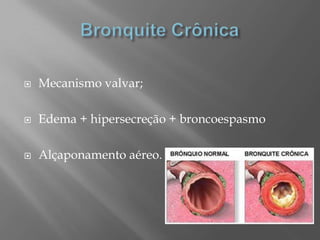  Mecanismo valvar;
 Edema + hipersecreção + broncoespasmo
 Alçaponamento aéreo.
 