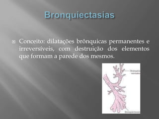  Conceito: dilatações brônquicas permanentes e
irreversíveis, com destruição dos elementos
que formam a parede dos mesmos.
 