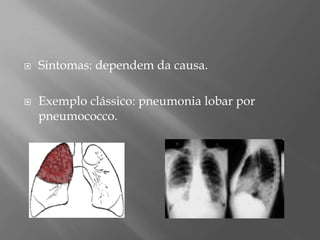  Sintomas: dependem da causa.
 Exemplo clássico: pneumonia lobar por
pneumococco.
 