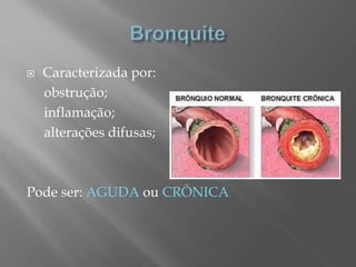  Caracterizada por:
obstrução;
inflamação;
alterações difusas;
Pode ser: AGUDA ou CRÔNICA
 