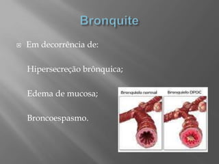  Em decorrência de:
Hipersecreção brônquica;
Edema de mucosa;
Broncoespasmo.
 