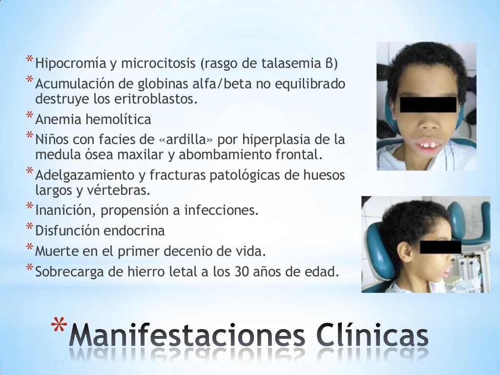 S ndromes Talas micos s-ndromes-talas-micos
