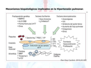 Mecanismos biopatológicos implicados en la Hipertensión pulmonar. 
 
