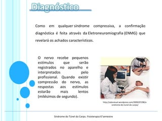 Como em qualquer síndrome compressiva, a confirmação
diagnóstica é feita através da Eletroneuromiografia (ENMG) que
revelará os achados característicos.
O nervo recebe pequenos
estímulos que serão
registrados no aparelho e
interpretados pelo
profissional. Quando existir
compressão do nervo, as
respostas aos estímulos
estarão mais lentos
(milésimos de segundo).
http://adoratual.wordpress.com/2009/07/08/a-
sindrome-do-tunel-do-carpo/
Síndrome do Túnel do Carpo. Fisioterapia 6°semestre
 