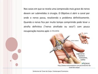 Nos casos em que se revela uma compressão mais grave do nervo
devem ser submetidos à cirurgia. O Objetivo é abrir o canal por
onde o nervo passa, resolvendo o problema definitivamente.
Quando o nervo fica por muito tempo comprimido pode levar a
atrofia definitiva (“nervo atrofiado ou seco”) com pouca
recuperação mesmo após a cirurgia.
http://www.institutobalsini.com.br/sindrome-do-
tunel-do-carpo/
Síndrome do Túnel do Carpo. Fisioterapia 6°semestre
 