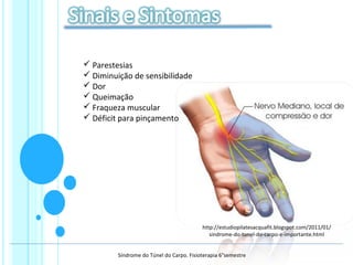  Parestesias
 Diminuição de sensibilidade
 Dor
 Queimação
 Fraqueza muscular
 Déficit para pinçamento
http://estudiopilatesacquafit.blogspot.com/2011/01/
sindrome-do-tunel-do-carpo-e-importante.html
Síndrome do Túnel do Carpo. Fisioterapia 6°semestre
 