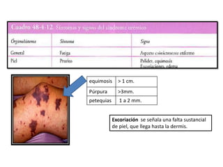equimosis > 1 cm.
Púrpura >3mm.
petequias 1 a 2 mm.
Excoriación se señala una falta sustancial
de piel, que llega hasta la dermis.