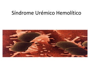Síndrome Urémico Hemolítico
 