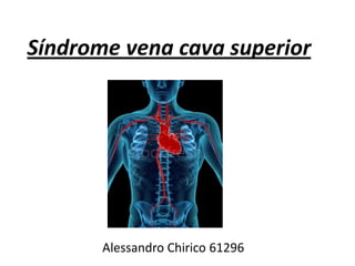 Síndrome vena cava superior




       Alessandro Chirico 61296
 