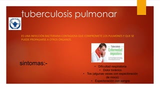 tuberculosis pulmonar 
ES UNA INFECCIÓN BACTERIANA CONTAGIOSA QUE COMPROMETE LOS PULMONES Y QUE SE 
PUEDE PROPAGARSE A OTROS ÓRGANOS. 
sintomas:- 
• Dificultad respiratoria 
• Dolor torácico 
• Tos (algunas veces con expectoración 
de moco) 
• Expectoración con sangre 
