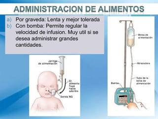 a) Por graveda: Lenta y mejor tolerada
b) Con bomba: Permite regular la
velocidad de infusion. Muy util si se
desea administrar grandes
cantidades.
 