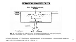 Zinc oxide eugenol as a cement and paste | PDF