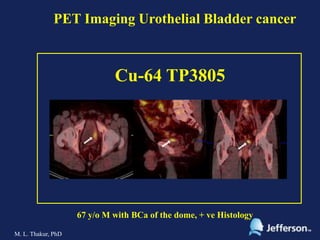PET Imaging of Urothelial Bladder Cancer | PPTX