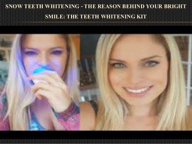 Snow Teeth Whitening The Reason Behind Your Bright Smile The Teeth