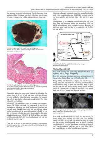Nguyên tắc tiếp cận và quản lý một khối ở phần phụ
Quản lý một khối thực thể không tân lập ở phần phụ: Nang lạc nội mạc tử cung ở buồng trứng. Ứ dịch vòi Fallope
2
lạc nội mạc tử cung ở buồng trứng. Thuyết Sampson cũng
giải thích được liên quan mật thiết giữa nang lạc nội mạc
tử cung ở buồng trứng với lạc nội mạc tử cung phúc mạc.
Hình 1a: Nang lạc tuyến nội mạc tử cung tại buồng trứng
Đại thể: giả nang, không vỏ bọc thật, lòng chứa dịch nâu chocolate.
Nguồn: ovarian-cyst-symptoms.info
Hình 1b: Nang lạc tuyến nội mạc tử cung tại buồng trứng
Vi thể: lòng nang lót bởi một lớp tế bào tuyến nội mạc tử cung với mô
đệm tùy hành, có thể có tẩm nhuận hemosiderin.
Nguồn: ovarian-cyst-symptoms.info
Tuy nhiên, việc trào ngược máu kinh chỉ là điều kiện cần
nhưng chưa đủ để gây ra một tình trạng lạc tuyến nội mạc
tử cung tại buồng trứng hay phúc mạc chậu. Cần phải có
các yếu tố ảnh hưởng trên qua trình cấy ghép, cho phép
tiến trình này hoàn tất.
Giả thuyết cấy ghép hiện đại giữ lại ý tưởng của Sampson,
nhưng cho rằng tế bào được cấy ghép là các tế bào có đặc
tính nguyên thủy hơn, tức là các progenitor chưa biệt hóa
của nội mạc. Sau khi được gieo rắc trên bề mặt buồng
trứng, các progenitor sẽ xâm nhập và phát triển khi và chỉ
khi có các điều kiện đáp ứng miễn dịch thuận lợi. Đột biến
tái cấu trúc các gene HMGA1 và HMGA2 được ghi nhận
có liên quan mật thiết đến hình thành của các cấu trúc lạc
tuyến nội mạc tử cung 1
.
1
Đột biến tái cấu trúc các gene HMGA1 và HMGA2 (High Mobility
Group A) quan sát thấy có liên quan nhiều đến các bất thường cấu trúc
lien quan đến trung biểu mô.
Đáp ứng miễn dịch bẩm sinh được kích hoạt dẫn đến tiến
trình viêm. Acid arachidonic rồi COX-2 và cuối cùng là
các prostaglandin gây ra biểu hiện viêm tại vị trí xâm
nhập.
Prostaglandin PGE2 của tiến trình viêm sẽ gián tiếp kích
hoạt tổng hợp estrogen thông qua aromatase P450 và
STAR (steroidogenic acute regulatory protein). Estrogen là
điều kiện quan trọng cho duy trì và phát triển các tổ chức
nội mạc lạc vị.
Hình 2: Thuyết cấy ghép, quá trình viêm và cường estrogen
Nguồn: pharmrev.aspetjournals.org
Hình ảnh học và CA125
Siêu âm là phương tiện quan trọng nhất để chẩn đoán lạc
tuyến nội mạc tử cung ở buồng trứng.
Trên siêu âm thang xám, nang lạc tuyến nội mạc tử cung ở
buồng trứng thường được xếp vào loại IIA hay IIB.
Trong trường hợp điển hình, nang lạc nội mạc tử cung ở
buồng trứng thể hiện trên siêu âm thang xám là một hay
nhiều cấu trúc nang, có phản âm kém đều. Nang có giới
hạn rõ với cấu trúc buồng trứng chung quanh, thường
không có chồi hay vách. Không có tăng dòng chảy quanh
nang. Mô tả IOTA không hiện diện các M-rules.
Hình 3: Nang lạc tuyến nội mạc tử cung ở buồng trứng trên siêu âm
thang xám (trái) và siêu âm Doppler (phải)
Nguồn: radiologyassistant.nl
Siêu âm là đủ để chẩn đoán lạc tuyến nội mạc tử cung ở
buồng trứng. Các phương tiện hình ảnh khác thường
không cần thiết cho việc xác lập chẩn đoán nang lạc tuyến
nội mạc tử cung ở buồng trứng. MRI có thể có ích trong
việc khảo sát và xác định thương tổn lạc tuyến nội mạc tử
cung tùy hành như lạc tuyến nội mạc tử cung thâm nhiễm
sâu vùng chậu khi có thống kinh hay giao hợp đau…
 