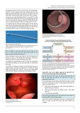 Quản lý một trường hợp xuất huyết tử cung bất thường
Quản lý xuất huyết tử cung bất thường ở tuổi quanh mãn kinh
4
thủ thuật đơn giản, rẻ tiền và tiện lợi hơn cho người bệnh.
Pipelle®
là một catheter nhựa, nhỏ, không gây đau, cho
phép thực hiện sinh thiết ở tại ngoại trú với gây tê tại chổ
hoặc thậm chí không biện pháp vô cảm nào được sử dụng.
Guido báo cáo sinh thiết bằng Pipelle®
cung cấp 97% mẫu
mô thích hợp và phát hiện 83% các trường hợp ung thư nội
mạc tử cung. Khi tổn thương chiếm hơn 50% bề mặt nội
mạc tử cung thì không ghi nhận có trường hợp bỏ sót nào.
Các trường hợp âm tính giả thường gặp là do tổn thương
nằm khu trú như polyps hoặc tăng sinh khu trú nội mạc tử
cung. Khả năng bỏ sót tổn thương lên đến 33% khi bề mặt
tổn thương khu trú dưới 5% diện tích buồng tử cung.
Hình 3: Dụng cụ sinh thiết Pipelle®
Dụng cụ có khẩu kính rất nhỏ, khoảng 1 mm, cho phép thực hiện sinh
thiết trong điều kiện phòng khám ngoại trú, không cần vô cảm.
Nguồn: dailymail.co.uk
Nội soi buồng tử cung cung cấp hình ảnh trực tiếp của nội
mạc tử cung và giúp sinh thiết (hoặc phẫu thuật lấy bỏ)
đúng vùng tổn thương cần khảo sát.
Nội soi buồng tử cung cung cấp các chi tiết tổng thể về
buồng tử cung và tổn thương nhìn thấy được. Sinh thiết
được thực hiện trên vùng tổn thương nhìn thấy.
Soi buồng tử cung đặc biệt có giá trị trong các trường hợp
sinh thiết mù không cho kết quả phù hợp với chẩn đoán
lâm sàng.
Tuy nhiên, soi buồng tử cung là một thủ thuật cần dụng cụ
chuyên dùng, thực hiện tại phòng mổ với nhân lực được
huấn luyện thành thạo. Do đó, cần lựa chọn đúng bệnh
nhân để tránh những can thiệp quá mức không cần thiết.
Hình 4a: Soi buồng tử cung
Hình ảnh đa polyps buồng tử cung.
Nguồn: youtube.com
Hình 4b: Cắt polyps bằng quai cao tần đơn cực
Sinh thiết được hướng dẫn dưới soi buồng tử cung
Nguồn: drkorennaya.ru
Lưu đồ 1: Lưu đồ tiếp cận xuất huyết tử cung bất thường quanh mãn
kinh trên cơ sở dùng siêu âm như phương tiện tiếp cận sơ cấp
Trong lưu đồ, độ dầy nội mạc tử cung qua siêu âm thực hiện qua đường
âm đạo vào N4-6 của chu kz là thông tin sơ cấp, giúp định hướng các
thăm dò thứ cấp, có thể là D&C hay soi buồng tử cung.
Nguồn: Bộ môn Phụ Sản, ĐHYD TPHM
NGUYÊN TẮC CỦA ĐIỀU TRỊ XUẤT HUYẾT TỬ
CUNG CƠ NĂNG QUANH MÃN KINH
Sau khi đã loại trừ hoàn toàn các nguyên nhân thực thể, có
thể cân nhắc đến việc điều trị các xuất huyết tử cung cơ
năng quanh mãn kinh.
Việc quyết định có hay không tiến hành các điều trị cầm
máu cho xuất huyết tử cung cơ năng quanh mãn kinh tùy
thuộc vào nhiều yếu tố:
 Tình trạng ảnh hưởng của xuất huyết bất thường có
nghiêm trọng hay không?
 Tình trạng hoạt động của buồng trứng ở thời điểm
hiện tại.
 Các yếu tố tùy hành khác.
Nếu xuất huyết nghiêm trọng, liệu pháp cầm máu nhanh và
hiệu quả nhất là nạo buồng tử cung.
Xuất huyết nghiêm trọng phần lớn là do sự sụp đổ của nội
mạc tử cung sau một thời gian dài phơi nhiễm với
estrogen.
 