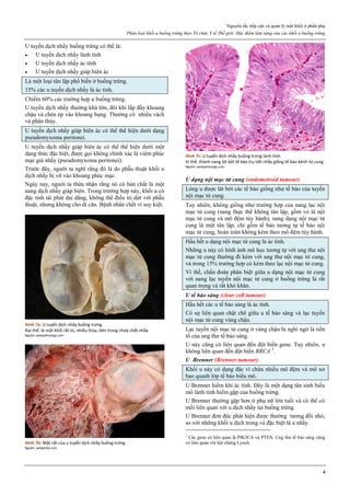 Nguyên tắc tiếp cận và quản lý một khối ở phần phụ
Phân loại khối u buồng trứng theo Tổ chức Y tế Thế giới. Đặc điểm lâm sàng của các khối u buồng trứng
4
U tuyến dịch nhầy buồng trứng có thể là:
 U tuyến dịch nhầy lành tính
 U tuyến dịch nhầy ác tính
 U tuyến dịch nhầy giáp biên ác
Là một loại tân lập phổ biến ở buồng trứng.
15% các u tuyến dịch nhầy là ác tính.
Chiếm 60% các trường hợp u buồng trứng.
U tuyến dịch nhầy thường khá lớn, đôi khi lấp đầy khoang
chậu và chèn ép vào khoang bụng. Thường có nhiều vách
và phân thùy.
U tuyến dịch nhầy giáp biên ác có thể thể hiện dưới dạng
pseudomyxoma peritonei.
U tuyến dịch nhầy giáp biên ác có thể thể hiện dưới một
dạng thức đặc biệt, được gọi không chính xác là viêm phúc
mạc giả nhầy (pseudomyxoma peritonei).
Trước đây, người ta nghĩ rằng đó là do phẫu thuật khối u
dịch nhầy bị vỡ vào khoang phúc mạc.
Ngày nay, người ta thừa nhận rằng nó có bản chất là một
nang dịch nhầy giáp biên. Trong trường hợp này, khối u có
đặc tính tái phát dai dẳng, không thể điều trị dứt với phẫu
thuật, nhưng không cho di căn. Bệnh nhân chết vì suy kiệt.
Hình 7a: U tuyến dịch nhầy buồng trứng.
Đại thể: là một khối rất to, nhiều thùy, bên trong chứa chất nhầy
Nguồn: webpathology.com
Hình 7b: Mặt cắt của u tuyến dịch nhầy buồng trứng
Nguồn: wikipedia.com
Hình 7c: U tuyến dịch nhầy buồng trứng lành tính.
Vi thể: thành nang lót bởi tế bào trụ tiết nhầy giống tế bào kênh tử cung.
Nguồn: webpathology.com
U dạng nội mạc tử cung (endometroid tumour)
Lòng u được lát bởi các tế bào giống như tế bào của tuyến
nội mạc tử cung.
Tuy nhiên, không giống như trường hợp của nang lạc nội
mạc tử cung (nang thực thể không tân lập, gồm vỏ là nội
mạc tử cung và mô đệm tùy hành), nang dạng nội mạc tử
cung là một tân lập, chỉ gồm tế bào tương tự tế bào nội
mạc tử cung, hoàn toàn không kèm theo mô đệm tùy hành.
Hầu hết u dạng nội mạc tử cung là ác tính.
Những u này có hình ảnh mô học tương tự với ung thư nội
mạc tử cung thường đi kèm với ung thư nội mạc tử cung,
và trong 15% trường hợp có kèm theo lạc nội mạc tử cung.
Vì thế, chẩn đoán phân biệt giữa u dạng nội mạc tử cung
với nang lạc tuyến nội mạc tử cung ở buồng trứng là rất
quan trọng và rất khó khăn.
U tế bào sáng (clear cell tumour)
Hầu hết các u tế bào sáng là ác tính.
Có sự liên quan chặt chẽ giữa u tế bào sáng và lạc tuyến
nội mạc tử cung vùng chậu.
Lạc tuyến nội mạc tử cung ở vùng chậu bị nghi ngờ là tiền
tố của ung thư tế bào sáng.
U này cũng có liên quan đến đột biến gene. Tuy nhiên, u
không liên quan đến đột biến BRCA 5
.
U Brenner (Brenner tumour)
Khối u này có dạng đặc vì chứa nhiều mô đệm và mô xơ
bao quanh lớp tế bào biểu mô.
U Brenner hiếm khi ác tính. Đây là một dạng tân sinh biểu
mô lành tính hiếm gặp của buồng trứng.
U Brenner thường gặp hơn ở phụ nữ lớn tuổi và có thể có
mối liên quan với u dịch nhầy tại buồng trứng.
U Brenner đơn độc phát hiện được thường tương đối nhỏ,
so với những khối u dịch trong và đặc biệt là u nhầy.
5
Các gene có liên quan là PIK3CA và PTEN. Ung thư tế bào sáng cũng
có liên quan với hội chứng Lynch.
 