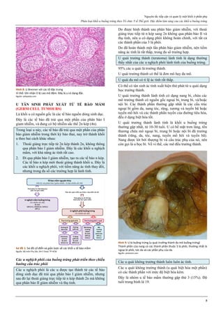 Nguyên tắc tiếp cận và quản lý một khối ở phần phụ
Phân loại khối u buồng trứng theo Tổ chức Y tế Thế giới. Đặc điểm lâm sàng của các khối u buồng trứng
5
Hình 8: U Brenner với các tổ đặc trưng
Vi thể: Ghi nhận tỉ lệ cao mô đệm. Đây là u có dạng đặc.
Nguồn: wikipedia.com
U TÂN SINH PHÁT XUẤT TỪ TẾ BÀO MẦM
(GERM CELL TUMOURS)
Là khối u có nguồn gốc là các tế bào nguồn dòng sinh dục.
Đây là các tế bào đã trải qua một phần của phân bào I
giam nhiễm, và đang có bộ nhiễm sắc thể 2n kép (4n).
Trong loại u này, các tế bào đã trải qua một phần của phân
bào giảm nhiễm trong thời kỳ bào thai, nay trở thành khối
u theo hai cách khác nhau:
1. Thoái giáng trực tiếp từ 2n kép thành 2n, không thông
qua phân bào I giảm nhiễm. Đây là các khối u nghịch
mầm, với khả năng ác tính rất cao.
2. Đi qua phân bào I giảm nhiễm, tạo ra các tế bào n kép.
Các tế bào n kép mới thoái giáng thành khối u. Đây là
các khối u nghịch phôi, với tiềm năng ác tính thay đổi,
nhưng trong đa số các trường hợp là lành tính.
Sơ đồ 1: Sơ đồ cổ điển và giản lược về các khối u tế bào mầm
Nguồn: Bộ môn Phụ Sản, ĐH Y Dược TP HCM
Các u nghịch phôi của buồng trứng phát triển theo chiều
hướng cấu trúc phôi
Các u nghịch phôi là các u được tạo thành từ các tế bào
dòng sinh dục đã trải qua phân bào I giảm nhiễm, nhưng
sau đó lại thoái giáng trực tiếp từ n kép thành 2n mà không
qua phân bào II giảm nhiễm và thụ tinh.
Do được hình thành sau phân bào giảm nhiễm, với thoái
giáng trực tiếp từ n kép sang 2n không qua phân bào II và
thụ tinh, nên u có dạng phôi không hoàn chỉnh, với tất cả
các thành phần của 3 lá phôi.
Do đã hoàn thành một lần phân bào giảm nhiễm, nên tiềm
năng ác tính là rất thấp, trong đa số trường hợp.
U quái trưởng thành (teratoma) lành tính là dạng thường
thấy nhất của các u nghịch phôi lành tính của buồng trứng.
95% các u quái là trưởng thành.
U quái trưởng thành có thể là đơn mô hay đa mô.
U quái đa mô có tỉ lệ ác tính rất thấp.
Có thể có tân sinh ác tính xuất hiện thứ phát từ u quái dạng
bọc trưởng thành.
U quái trưởng thành lành tính có dạng nang bì, chứa các
mô trưởng thành có nguồn gốc ngoại bì, trung bì, và/hoặc
nội bì. Các thành phần thường gặp nhất là các cấu trúc
ngoại bì gồm da, nang tóc, răng, xương và tuyến bã hoặc
tuyến mồ hôi và các thành phần tuyến của đường tiêu hóa,
đều ở dạng biệt hóa tốt.
U quái trưởng thành lành tính là khối u buồng trứng
thường gặp nhất, từ 10-30 tuổi. U có bề mặt trơn láng, tổn
thương chứa mô ngoại bì, trung bì hoặc nội bì đã trưởng
thành (răng, da, tóc, nang, tuyến mồ hôi và tuyến bã).
Nang được lót bởi thượng bì và cấu trúc phụ của nó, nên
còn gọi là u bọc bì. Về vi thể, các mô đều trưởng thành.
Hình 9: U bì buồng trứng (u quái trưởng thành đa mô buồng trứng)
Thành phần của nang có các thành phần thuộc 3 lá phôi, thường nhất là
ngoại bì phôi, tức da và các phần phụ của da.
Nguồn: pinterest.com
Các u quái không trưởng thành luôn luôn ác tính.
Các u quái không trưởng thành (u quái biệt hóa một phần)
có các thành phần với mức độ biệt hóa kém.
Đây là nhóm u tế bào mầm thường gặp thứ 3 (15%). Độ
tuổi trung bình là 19.
 