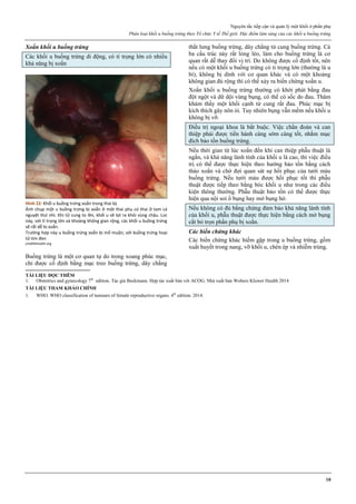 Nguyên tắc tiếp cận và quản lý một khối ở phần phụ
Phân loại khối u buồng trứng theo Tổ chức Y tế Thế giới. Đặc điểm lâm sàng của các khối u buồng trứng
10
Xoắn khối u buồng trứng
Các khối u buồng trứng di động, có tỉ trọng lớn có nhiều
khả năng bị xoắn
Hình 22: Khối u buồng trứng xoắn trong thai kz
Ảnh chụp một u buồng trứng bị xoắn ở một thai phụ có thai ở tam cá
nguyệt thứ nhì. Khi tử cung to lên, khối u sẽ lọt ra khỏi vùng chậu. Lúc
này, với tỉ trọng lớn và khoảng không gian rộng, các khối u buồng trứng
sẽ rất dễ bị xoắn.
Trường hợp này u buồng trứng xoắn bị mổ muộn, với buồng trứng hoại
tử tím đen
jmidlifehealth.org
Buồng trứng là một cơ quan tự do trong xoang phúc mạc,
chỉ được cố định bằng mạc treo buồng trứng, dây chằng
thắt lưng buồng trứng, dây chằng tử cung buồng trứng. Cả
ba cấu trúc này rất lỏng lẻo, làm cho buồng trứng là cơ
quan rất dễ thay đổi vị trí. Do không được cố định tốt, nên
nếu có một khối u buồng trứng có tỉ trọng lớn (thường là u
bì), không bị dính với cơ quan khác và có một khoảng
không gian đủ rộng thì có thể xảy ra biến chứng xoắn u.
Xoắn khối u buồng trứng thường có khởi phát bằng đau
đột ngột và dữ dội vùng bụng, có thể có sốc do đau. Thăm
khám thấy một khối cạnh tử cung rất đau. Phúc mạc bị
kích thích gây nôn ói. Tuy nhiên bụng vẫn mềm nếu khối u
không bị vỡ.
Điều trị ngoại khoa là bắt buộc. Việc chẩn đoán và can
thiệp phải được tiến hành càng sớm càng tốt, nhằm mục
đích bảo tồn buồng trứng.
Nếu thời gian từ lúc xoắn đến khi can thiệp phẫu thuật là
ngắn, và khả năng lành tính của khối u là cao, thì việc điều
trị có thể được thực hiện theo hướng bảo tồn bằng cách
tháo xoắn và chờ đợi quan sát sự hồi phục của tưới máu
buồng trứng. Nếu tưới máu được hồi phục tốt thì phẫu
thuật được tiếp theo bằng bóc khối u như trong các điều
kiện thông thường. Phẫu thuật bảo tồn có thể được thực
hiện qua nội soi ổ bụng hay mở bụng hở.
Nếu không có đủ bằng chứng đảm bảo khả năng lành tính
của khối u, phẫu thuật được thực hiện bằng cách mở bụng
cắt bỏ trọn phần phụ bị xoắn.
Các biến chứng khác
Các biến chứng khác hiếm gặp trong u buồng trứng, gồm
xuất huyết trong nang, vỡ khối u, chèn ép và nhiễm trùng.
TÀI LIỆU ĐỌC THÊM
1. Obstetrics and gynecology 7th
edition. Tác giả Beckmann. Hợp tác xuất bản với ACOG. Nhà xuất bản Wolters Kluwer Health 2014
TÀI LIỆU THAM KHẢO CHÍNH
1. WHO. WHO classification of tumours of female reproductive organs. 4th
edition. 2014.
 