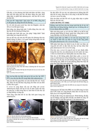 Nguyên tắc tiếp cận và quản lý các khối u lành tính của tử cung
Vai trò của hình ảnh học trong các bệnh lý lành tính ở tử cung
3
Gần đây, có hai phương tiện hình ảnh khảo sát khác, cũng
dựa trên nền tảng siêu âm, đã được dùng cho mục đích
nhận diện và phân biệt adenomyosis: siêu âm 4D và siêu
âm đàn hối.
Siêu âm 4D “nhập khẩu” khái niệm JZ từ MRI, đồng thời
có thể giúp xây dựng bản đồ tổn thương.
So với siêu âm grey-scale hay siêu âm Doppler, siêu âm
4D có 2 ưu thế quan trọng:
Khả năng xây dựng hình ảnh 3 chiều động làm cho việc
lập bản đồ tổn thương dễ dàng hơn.
Độ phân giải hình ảnh cao, cho phép “nhập khẩu” khái
niệm khảo sát vùng kết nối (JZ).
Hai ưu thế này của siêu âm 4D giúp cho phương tiện này
nhanh chóng có được vị trí quan trọng trong khảo sát các
cấu trúc lành tính của tử cung.
Hình 9: Các ưu thế của siêu âm 4D
Hình 9a (trái) cho phép nhận diện được JZ (đường viện tối màu quanh
nội mạc tử cung.
Hình 9b (phải) cho phép thiết lập bản đồ phân bố của các cấu trúc cần
khảo sát.
Nguồn: accessObGyn. McGraw-Hill Medical
Báo cáo ban đầu cho thấy tính giá trị rất cao (Se, Sp, NPV,
PPV) của siêu âm đàn hồi trong nhận diện adenomyosis.
Siêu âm đàn hồi giúp khảo sát mức độ đàn hồi mô. Trước
đây, khảo sát này đã được ứng dụng cho khảo sát các khối
u khác như u gan…
U xơ-cơ tử cung được cấu tạo chỉ bằng mô cơ-sợi.
Adenomyosis được cấu tạo từ các tổ chức tuyến nội mạc
tử cung lạc vị nằm trong lớp cơ, kèm theo là cấu trúc sợi
cơ tăng dưỡng và tăng sản.
Tính cứng, kém đàn hồi là các đặc tính quan trọng của
adenomyosis.
Hình 10: Siêu âm đàn hồi mô cho adenomyosis
Cấu trúc adenomyosis là các cấu trúc cứng, kém đàn hồi (đỏ).
Các vùng có độ đàn hồi cao là các vùng cơ tử cung có cấu trúc mô học
bình thường.
Nguồn: ultrasoundimaging.blogspot.com
Do đặc điểm cấu tạo này mà adenomyosis không đàn hồi
như mô tử cung, cũng như có độ cứng và độ đàn hồi khác
với các u xơ-cơ tử cung.
Siêu âm khảo sát đàn hồi mô sẽ giúp nhận diện và phân
biệt các cấu trúc này.
CỘNG HƯỞNG TỪ (MRI)
Không vượt trội hơn siêu âm trong tuyệt đại đa số các chỉ
định khảo sát thông thường, thành giá cao và không sẵn có
là các nhược điểm của MRI.
Một cách tổng quát, so với siêu âm, MRI có ưu thế là một
phương pháp không lệ thuộc người đọc, đồng thời có thể
cung cấp được chi tiết bản đồ tổn thương.
Điểm mạnh nhất của MRI so với siêu âm trong khảo sát
các bệnh lý lành tính của thân tử cung là khả năng phân
biệt giữa adenomyosis với u xơ-cơ tử cung.
MRI phân biệt được hai bệnh lý này là nhờ vào khảo sát
vùng kết nối (JZ) và đặc tính cấu trúc mô học khác biệt
giữa adenomyosis với u xơ-cơ tử cung.
Cấu trúc của u xơ-cơ tử cung là mô cơ sợi, thuần nhất,
trong khi cấu trúc của adenomyosis là mô tuyến nội mạc,
vì thế sẽ có hình ảnh các thành phần cấu trúc khác nhau.
Siêu âm có thể không phân định được giữa u xơ-cơ tử
cung và adenomyosis trong trường hợp u xơ-cơ tử cung có
thoái hóa, do cấu trúc trở nên không đồng nhất. Trong các
tình huống này, MRI sẽ là một phương pháp hữu hiệu để
giúp thực hiện chẩn đoán phân biệt.
Hình 11: Hình ảnh MRI của adenomyosis (trái) và u xơ-cơ tử cung (phải).
Trong adenomyosis, trên T2W, các ổ xuất huyết nhỏ thể hiện bằng các
điểm tăng tín hiệu.
Các u xơ-cơ tử cung có biểu hiện trên MRI như các vùng có tín hiệu kém.
Nguồn: keyword-suggestions.com
Adenomyosis thể hiện trên MRI với các điểm tăng tín hiệu
trên T2W, hoặc các vùng khuyết, khác hẳn với cấu trúc tín
hiệu của cơ tử cung bình thường.
JZ dầy là đặc trưng của adenomyosis. Bình thường, độ dầy
của JZ không vượt quá 40% độ dầy của thành tử cung. JZ
dầy trên 40% là một dấu hiệu gợi ý của adenomyosis.
Hình 12: Junctional Zone (JZ) trong adenomyosis
JZ thể hiện trên T2W là vùng tín hiệu kém nằm giữa nội mạc tử cung
chức năng có tín hiệu mạnh và cơ tử cung có tín hiệu yếu.
Nguồn: Bộ môn Phụ Sản ĐH Y Dược TP HCM
 