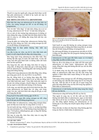 Nguyên tắc tiếp cận và quản lý các khối u lành tính của tử cung
Bệnh tuyến-cơ tử cung (adenomyosis): bệnh sinh và một số vấn đề liên quan
5
Thuyết tử cung hai nguồn gốc cũng giải thích được sự kết
hợp giữa adenomyosis và bệnh lý lạc tuyến nội mạc tử
cung sâu trong vùng chậu.
ĐẶC ĐIỂM LÂM SÀNG CỦA ADENOMYOSIS
Biểu hiện lâm sàng của adenomyosis là các biệu hiện của
viêm, của cường estrogen tại chỗ và của đề kháng với
progesterone.
Trái với tính “trầm lặng” về mặt triệu chứng của u-xơ cơ
tử cung, adenomyosis rất “ồn ào” về mặt triệu chứng học.
Chỉ có một số nhỏ trường hợp adenomyosis là không có
triệu chứng lâm sàng, chỉ phát hiện khi khám định kỳ thấy
một tử cung to, với những đặc trưng hình ảnh học của
adenomyosis.
Trong đa phần các trường hợp, adenomyosis thường biệu
hiện các triệu chứng của viêm, của cường estrogen tại chỗ
và của đề kháng với progesterone.
Thống kinh là than phiền thường thấy nhất của
adenomyosis.
Lúc đầu là đau do viêm, sau đó là viêm thần kinh sinh
mạch và cuối cùng là đau do nhạy cảm trung ương.
Đau bụng kinh trong adenomyosis khá điển hình. Đau
thường bắt đầu ngay từ trước khi hành kinh, và kéo dài
trong suốt thời gian hành kinh và không chấm dứt hoàn
toàn sau khi sạch kinh.
Đau bụng kéo dài, mức độ nặng, kèm theo tử cung to,
cứng chắc, di động kém, chạm đau gợi ý tình trạng thống
kinh do adenomyosis, chứ không phải một trường hợp đau
bụng kinh thông thường.
Thống kinh trong adenomyosis khởi đầu bằng viêm, thông
qua trung gian của IL-1β, của COX-2 và của PGE2.
Sau đó, thống kinh có xu hướng tăng nặng dần. Hiện
tượng tăng nặng của thống kinh là do sự hiện diện của
viêm thần kinh-sinh mạch. Viêm thần kinh-sinh mạch là
hệ quả của cường estrogen, chuyển dạng các macrophage,
tân tạo mạch và sinh thần kinh hướng về tổn thương.
Cuối cùng, sau một thời gian dài bị kích thích bởi đau, đau
trong adenomyosis trở thành đau với nhạy cảm trung
ương. Lúc này, một kích thích nhỏ cũng đủ để gây ra một
tình trạng đau dữ dội.
Rong huyết là than phiền thường gặp (AUB-A).
Rong huyết liên quan đến cường estrogen tại chỗ, cũng
như là hệ quả của đề kháng progesterone.
Ở bệnh nhân với adenomyosis, cường năng estrogen được
quan sát thấy tại cả nội mạc tử cung chính vị và lạc vị.
Tại mô tuyến nội mạc chính vị và lạc vị, sự tăng hoạt động
của men aromatase P450 và bất thường trong hoạt động của
men 17-β hydroxy dehydrogenase gây ra tăng bất thường
của estrogen tại chỗ.
Nội mạc tử cung dầy, kèm theo chảy máu tử cung bất
thường khá thường gặp.
Hình 14: Adenomyosis qua soi buồng tử cung.
Nội mạc tử cung dầy cục bộ với các vùng tuyến xâm nhập.
Nguồn: abdel-gadir.com
Xuất huyết tử cung bất thường do cường estrogen trong
adenomyosis gây ra những khó khăn trong điều trị, do kèm
theo đó là hiện tượng đề kháng với progesterone.
Do tình trạng đề kháng với progesterone nên điều trị AUB-
A bằng các liệu pháp trên nền progestin thường hoạt động
kém hiệu quả.
Adenomyosis có liên quan đến hiếm muộn và tỉ lệ thành
công thấp của điều trị hiếm muộn.
Hiện tại, đã có đủ chứng cứ xác nhận mối liên quan giữa
adenomyosis và hiếm muộn. Adenomyosis gây hiếm
muộn, đồng thời cũng ảnh hưởng đến kết cục của các điều
trị hiếm muộn.
Tỉ lệ thành công của thụ tinh trong ống nghiệm ở bệnh
nhân có adenomyosis thấp hơn của thụ tinh trong ống
nghiệm ở bệnh nhân hiếm muộn không có liên quan với
adenomyosis.
Tình trạng cường estrogen tại chỗ, đề kháng progesterone
có ảnh hưởng trực tiếp đến hiện tượng làm tổ của trứng đã
thụ tinh. Thất bại làm tổ là một yếu tố quan trọng làm
giảm khả năng thành công của thụ tinh trong ống nghiệm ở
bệnh nhân có adenomyosis.
Adenomyosis có ảnh hưởng trên khả năng mang thai cũng
kết cục của thai kỳ.
Adenomyosis cũng ảnh hưởng đến kết cục thai kỳ.
Thai ngoài tử cung xảy ra với tần xuất cao hơn bình
thường trên bệnh nhân có adenomyosis, ngay cả trên bệnh
nhân đã bị cắt bỏ hai vòi Fallope. Người ta giả định rằng
các nhu động nghịch thường của adenomyosis có xu
hướng gây ra các dòng vận chuyển ngược dòng về phía vòi
Fallope.
Nhau tiền đạo và nhau cài răng lược cũng thường gặp hơn
trong các thai kỳ ở bệnh nhan có adenomyosis.
TÀI LIỆU ĐỌC THÊM
1. Obstetrics and gynecology 8th
edition. Tác giả Beckmann. Hợp tác xuất bản với ACOG. Nhà xuất bản Wolters Kluwer Health 2018
TÀI LIỆU THAM KHẢO CHÍNH
1. Comprehensive gynecology 7th
edition. Tác giả Lobo RA. Nhà xuất bản Elsevier 2017.
 