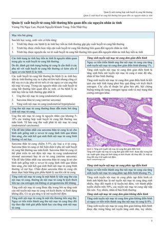 Quản lý một trường hợp xuất huyết tử cung bất thường
Quản lý xuất huyết tử cung bất thường liên quan đến các nguyên nhân ác tính
1
Quản lý xuất huyết tử cung bất thường liên quan đến các nguyên nhân ác tính
Vương Thị Ngọc Lan, Huỳnh Nguyễn Khánh Trang, Trần Nhật Huy
Mục tiêu bài giảng
Sau khi học xong, sinh viên có khả năng:
1. Trình bày được các bệnh lý ác tính hay tiền ác tính thường gặp gây xuất huyết tử cung bất thường
2. Trình bày được chiến lược tiếp cận xuất huyết tử cung bất thường liên quan đến nguyên nhân ác tính
3. Trình bày được nguyên tắc xử trí xuất huyết tử cung bất thường liên quan đến nguyên nhân ác tính hay tiền ác tính
Các tình trạng ác tính hay tiền ác tính là nguyên nhân quan
trọng gây ra xuất huyết tử cung bất thường.
Do đó, đánh giá tình trạng buồng tử cung là cần thiết ở các
phụ nữ với xuất huyết tử cung bất thường có kèm yếu tố
nguy cơ của bệnh lý ác tính.
Các xuất huyết tử cung bất thường do bệnh lý ác tính hay
tiền ác tính thường xảy ra ở phụ nữ lớn tuổi nhưng cũng có
thể xảy ra ở các phụ nữ trẻ tuổi có các nguy cơ của ung thư
nội mạc tử cung. Trong các nguyên nhân của xuất huyết tử
cung bất thường liên quan đến ác tính, có ba bệnh lý ác
tính hay tiền ác tính thường gặp nhất là
1. Ung thư nội mạc tử cung (endometrial carcinoma)
2. Sarcoma thân tử cung (uterine sarcoma)
3. Tăng sinh nội mạc tử cung (endometrial hyperplasia)
Ung thư nội mạc tử cung thường được dẫn trước bởi tăng
sinh nội mạc tử cung.
Ung thư nội mạc tử cung là nguyên nhân của khoảng 5-
10% các trường hợp xuất huyết tử cung bất thường sau
mãn kinh. Tế bào ung thư xuất phát từ nội mạc tử cung
(endometrial carcinoma).
Vấn đề khó khăn nhất của sarcoma thân tử cung là nó cho
hình ảnh giống một u xơ-cơ tử cung lành tính qua khám
lâm sàng, cho một kết quả sinh thiết nội mạc tử cung bình
thường về mô học.
Sarcoma thân tử cung chiếm 3-5% các loại u ở tử cung.
Sarcoma thân tử cung có thể hiện diện ở phụ nữ xuất huyết
tử cung bất thường sau mãn kinh. Sarcoma thân tử cung có
thể phát triển từ mô đệm nội mạc tử cung (endometrial
stromal sarcomas) hay từ cơ tử cung (uterine sarcoma).
Vấn đề khó khăn nhất của sarcoma thân tử cung là nó cho
hình ảnh giống một u xơ-cơ tử cung lành tính qua khám
lâm sàng, cho một kết quả sinh thiết nội mạc tử cung bình
thường về mô học. Chẩn đoán sarcoma thân tử cung chỉ
được thực hiện bằng giải phẫu bệnh lý sau khi cắt tử cung.
Tăng sinh nội mạc tử cung là một bệnh lý tiền ung thư của
nội mạc tử cung, thường do nội mạc tử cung bị kích thích
liên tục của estrogen mà không có progesterone đối kháng.
Tăng sinh nội mạc tử cung được đặc trưng bởi sự tăng sinh
của mô tuyến nội mạc tử cung với kích thước và hình dạng
không đều. Có sự gia tăng tỉ lệ mô tuyến/mô đệm.
Tăng sinh nội mạc tử cung là một tổn thương tiền ung thư.
Nguy cơ tiến triển thành ung thư nội mạc tử cung thay đổi
tùy theo đặc tính giải phẫu bệnh học của tăng sinh nội mạc
tử cung.
Tăng sinh tuyến nội mạc tử cung đơn giản điển hình
Nguy cơ tiến triển thành ung thư nội mạc tử cung của tăng
sinh tuyến nội mạc tử cung đơn giản điển hình khoảng 1%.
Tăng sinh tuyến nội mạc tử cung đơn giản điển hình là
tăng sinh biểu mô tuyến nội mạc tử cung ở mức độ nhẹ,
nhân tế bào bình thường.
Tăng sinh tuyến nội mạc tử cung đơn giản điển hình là kết
quả của một tình trạng phơi bày quá đáng với kích thích
estrogen. Các yếu tố thuận lợi gồm béo phì, hội chứng
buồng trứng đa nang, estrogen ngoại sinh và mọi trạng thái
cường estrogen khác.
Hình 1: Tăng sinh tuyến nội mạc tử cung đơn giản điển hình
Tăng sinh tuyến nội mạc tử cung đơn giản điển hình được đặc trưng bởi
các tuyến giãn rộng với hình dạng và kích thước rất thay đổi. Có một sự
thay đổi nhẹ tỉ lệ tuyến:mô đệm.
Nguồn: webpathology.com
Tăng sinh tuyến nội mạc tử cung phức tạp điển hình
Nguy cơ tiến triển thành ung thư nội mạc tử cung của tăng
sinh tuyến nội mạc tử cung phức tạp điển hình khoảng 3%.
Tăng sinh tuyến nội mạc tử cung phức tạp điển hình có
hình ảnh bệnh học là mô tuyến nội mạc tử cung tăng sinh
nhiều, thay đổi mạnh tỉ lệ tuyến:mô đệm, với thành phần
tuyến chiếm trên 50%, các tuyến nội mạc tử cung sắp xếp
lộn xộn. Tuy nhiên, nhân tế bào bình thường.
Tăng sinh nội mạc tử cung đơn giản không điển hình
Tăng sinh tuyến nội mạc tử cung đơn giản không điển hình
có nguy cơ tiến triển thành ung thư nội mạc tử cung là 8%.
Tăng sinh tuyến nội mạc tử cung đơn giản không điển hình
được đặc trưng bằng mô tuyến tăng sinh nhẹ, tuy nhiên,
 