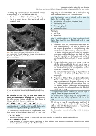 Quản lý một trường hợp xuất huyết tử cung bất thường
Quản lý xuất huyết tử cung bất thường liên quan đến rối loạn phóng noãn (xuất huyết tử cung cơ năng)
3
Các trường hợp sau nên được chỉ định sinh thiết nội mạc
tử cung do nguy cơ ác tính cao ở các nhóm này
 Phụ nữ trên 35 tuổi bị xuất huyết tử cung chức năng
 Phụ nữ vô kinh 1 năm hay nhiều hơn bị xuất huyết tử
cung chức năng
Hình 2: Hình ảnh siêu âm của hội chứng buồng trứng đa nang
Hình chuỗi hạt kinh điển của buồng trứng đa nang. Các nang noãn nhỏ
xếp thành chuỗi, phân bố ở ngoại vi buồng trứng.
Nguồn: learningradiology.com
Hình 2: Hình ảnh siêu âm bơm nước của polyps buồng tử cung (SIS)
SIS được chỉ định khi nghi có tổn thương thực thể trong buồng tử cung.
Nguồn: ilovemygyn.com
Nội soi buồng tử cung cung cấp thêm thông tin và loại
trừ các nguyên nhân thực thể tại tử cung và buồng trứng.
Soi buồng tử cung chỉ thực hiện khi cần thiết, thường là
khi nghi ngờ có tổn thương ở lòng tử cung.
XỬ TRÍ XUẤT HUYẾT TỬ CUNG CHỨC NĂNG
Mục tiêu của xử trí xuất huyết tử cung bất thường gồm
cầm máu và tái lập chu kỳ kinh nguyệt bình thường.
Tuy xuất huyết tử cung bất thường là vấn đề chủ của bệnh
nhân, nhưng ở bệnh nhân với xuất huyết tử cung chức
năng trong độ tuổi sinh sản thì còn có nhiều yếu tố tùy
hành ảnh hưởng đến động thái can thiệp điều trị.
Việc chọn lựa biện pháp xử trí xuất huyết tử cung bất
thường dựa trên nhiều yếu tố:
1. Nguyên nhân xuất huyết tử cung chức năng
2. Mức độ chảy máu
3. Tuổi người phụ nữ
4. Mong muốn có thai
Xử trí gồm:
 Nội khoa
 Ngoại khoa
Điều trị nội khoa trên cơ sở sử dụng nội tiết ngoại sinh
thường được thực hiện trong điều trị xuất huyết tử cung
bất thường.
1. Thuốc viên tránh thai estrogen-progestogen phối hợp
được dùng với mục đích làm giảm sự phát triển nội
mạc tử cung, tái tạo lại chu kỳ kinh bình thường, giảm
lượng máu kinh và giảm nguy cơ thiếu máu thiếu sắt.
Lưu ý rằng chỉ có các loại thuốc tránh thai estrogen-
progestogen phối hợp hàm lượng tiêu chuẩn mới được
dùng cho mục đích này. Không dùng các thuốc có
hàm lượng ethinyl estradiol dưới 20 µg cho mục đích
này.
2. Estrogen thường được dùng trong những trường hợp
xuất huyết tử cung kéo dài làm nội mạc tử cung bị
mỏng đi. Estrogen nhằm phục hồi nội mạc tử cung và
cầm máu trước tiên, giúp tái tạo sự phát triển nội mạc
tử cung một cách nhanh chóng.
Tuy nhiên, mọi nội mạc tử cung có được nhờ điều trị
với estrogen đơn thuần phải được tiếp tục với
progestogen.
3. Progestins có thể được dùng đơn độc trong điều trị lâu
dài các xuất huyết tử cung chức năng cần nội mạc tử
cung được tiếp xúc với progestins có chu kỳ và liên
tục. Progestogen kéo dài đối kháng lại tác dụng của
việc phơi bày dài ngày với estrogen, là liệu pháp chính
trong các trường hợp có tăng sinh đơn giản điển hình
của nội mạc tử cung.
Điều trị ngoại khoa là biện pháp chủ yếu cho xuất huyết tử
cung bất thường do nguyên nhân thực thể.
Với xuất huyết tử cung cơ năng, điều trị ngoại khoa chỉ
được chỉ định trong trường hợp thất bại với điều trị nội
khoa.
Đốt nội mạc tử cung để ngưng hay giảm xuất huyết tử
cung một cách lâu dài, tuy nhiên, đốt nội mạc cũng đồng
nghĩa là chấm dứt khả năng mang thai, có ý nghĩa tương
đượng với phẫu thuật cắt tử cung.
Cắt tử cung được xem xét khi thất bại với tất cả các điều
trị khác.
TÀI LIỆU ĐỌC THÊM
1. Obstetrics and gynecology 7th
edition. Tác giả Beckmann. Hợp tác xuất bản với ACOG. Nhà xuất bản Wolters Kluwer Health 2014.
TÀI LIỆU THAM KHẢO CHÍNH
1. ACOG, Committee on Gynecologic Practice. Management of Acute Abnormal Uterine Bleeding in Nonpregnant Reproductive-Aged Women.
Committee opinion. Number 557, April 2013. (Reaffirmed 2015).
 