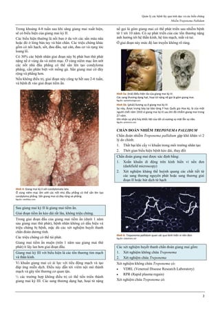 Quản lý các bệnh lây qua tình dục và các biến chứng
Nhiễm Treponema Pallidum
2
Trong khoảng 4-8 tuần sau khi săng giang mai xuất hiện,
sẽ có biểu hiện của giang mai kỳ II.
Các biểu hiện thường là nổi ban ở da với các sẩn màu nâu
hoặc đỏ ở lòng bàn tay và bàn chân. Các triệu chứng khác
gồm có nổi hạch, sốt, đau đầu, sụt cân, đau cơ và rụng tóc
loang lổ.
Có 30% các bệnh nhân giai đoạn này bị phát ban thứ phát
nặng nề ở vùng da và niêm mạc. Ở vùng niêm mạc ẩm ướt
các nốt nhú đầu phẳng có thể sẩn lên tạo condyloma
phẳng, cần phân biệt với mồng gà. Sẩn giang mai có đáy
rộng và phẳng hơn.
Nếu không điều trị, giai đoạn này cũng tự hết sau 2-6 tuần,
và bệnh đi vào giai đoạn tiềm ẩn.
Hình 4: Giang mai kz II với condylomata lata
Ở vùng niêm mạc ẩm ướt các nốt nhú đầu phẳng có thể sẩn lên tạo
condyloma phẳng. Sẩn giang mai có đáy rộng và phẳng.
Nguồn: medlibes.com
Sau giang mai kỳ II là giang mai tiềm ẩn.
Giai đoạn tiềm ẩn kéo dài rất lâu, không triệu chứng.
Trong giai đoạn đầu của giang mai tiềm ẩn (dưới 1 năm
sau giang mai thứ phát), bệnh nhân không có dấu hiệu và
triệu chứng bị bệnh, mặc dù các xét nghiệm huyết thanh
chẩn đoán dương tính.
Các triệu chứng có thể tái phát.
Giang mai tiềm ẩn muộn (trên 1 năm sau giang mai thứ
phát) ít lây lan hơn giai đoạn đầu.
Giang mai kỳ III với biểu hiện là các tổn thương tim mạch
và thần kinh.
Vi khuẩn giang mai có ái lực với tiểu động mạch và tạo
đáp ứng miễn dịch. Điều này dẫn tới viêm nội mô thành
mạch và gây tổn thương cơ quan tận.
⅓ các trường hợp không điều trị có thể tiến triển thành
giang mai kỳ III. Các sang thương dạng hạt, hoại tử nặng
nề gọi là gôm giang mai có thể phát triển sau nhiễm bệnh
từ 1 tới 10 năm. Có sự phát triển của các tổn thương nặng
ảnh hưởng tới hệ thần kinh, hệ tim mạch, mắt và tai.
Ở giai đoạn này mức độ lan truyền không rõ ràng.
Hình 5a: (trái) Biểu hiện da của giang mai kz III
Các sang thương dạng hạt, hoại tử nặng nề gọi là gôm giang mai.
Nguồn: ophtalmologie.pro
Hình 5b: (phải) Xương sọ ở giang mai kz III
Sọ này, được trưng bày tại bảo tàng Y học Quốc gia Hoa kz, là của một
người chết năm 1910 vì giang mai kz III sau khi đã nhiễm giang mai trong
27 năm.
Ghi nhận sự phá hủy khốc liệt của tất cả xương sọ mặt lẫn sọ não.
Nguồn: pinterest.com
CHẨN ĐOÁN NHIỄM TREPONEMA PALLIDUM
Chẩn đoán nhiễm Treponema pallidium gặp khó khăn vì 2
lý do chính:
1. Thất bại khi cấy vi khuẩn trong môi trường nhân tạo
2. Thời gian biểu hiện bệnh kéo dài, thay đổi
Chẩn đoán giang mai được xác định bằng:
1. Xoắn khuẩn di động trên kính hiển vi nền đen
(darkfield microscopy)
2. Xét nghiệm kháng thể huỳnh quang các chất tiết từ
các sang thương nguyên phát hoặc sang thương giai
đoạn II hoặc hút dịch từ hạch
Hình 6: Treponema pallidum quan sát qua kính hiển vi nền đen
Nguồn: slideshare.net
Các xét nghiệm huyết thanh chẩn đoán giang mai gồm:
1. Xét nghiệm không chứa Treponema
2. Xét nghiệm chứa Treponema
Xét nghiệm không chứa Treponema có:
 VDRL (Venereal Disease Research Laboratory)
 RPR (Rapid plasma regain)
Xét nghiệm chứa Treponema có:
 