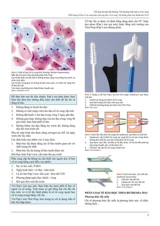 Tiết dịch âm đạo bất thường. Tổn thương lành tính ở cổ tử cung
Phết mỏng tế bào cổ tử cung tầm soát ung thư cổ tử cung. Hệ thống phân loại Bethesda 2014
2
Hình 1: Phết tế bào cổ tử cung bình thường. Nhuộm Papanicolaou.
Mẫu lấy trải lame theo phương pháp Thin Prep.
Các tế bào biểu mô bề mặt là những tế bào rộng, màu hồng hay xanh, có
nhân nhỏ, đậm.
Các tế bào trung gian là những tế bào màu xanh, có nhân hơi rộng hơn
tế bào bề mặt.
Trên lame này không tìm thấy tế bào chuyển sản.
Nguồn: capitalpath.com.au
Để đảm bảo test đủ tiêu chuẩn, Pap’s test phải được thực
hiện khi đảm bảo những điều kiện cần thiết để lấy đủ và
đúng tế bào.
1. Không đang ra huyết âm đạo
2. Không có tình trạng viêm âm đạo-cổ tử cung cấp tính
3. Không đặt thuốc ở âm đạo trong vòng 3 ngày gần đây
4. Không giao hợp, không thụt rửa âm đạo trong vòng 48
giờ trước thực hiện phết tế bào
5. Không khám âm đạo bằng tay trước đó, không dùng
dầu bôi trơn trước đó
Phụ nữ mãn kinh nên được dùng estrogen tại chỗ vài ngày
trước khi lấy mẫu
Các điều kiện này nhằm vào 2 mục đích:
1. Đảm bảo lấy được đúng các tế bào muốn quan sát với
chất lượng tốt nhất.
2. Đảm bảo lấy đủ lượng tế bào muốn khảo sát.
Khi thực hiện Pap’s test, cần tuân thủ qui trình:
Phải cung cấp đủ thông tin cần thiết cho người đọc tế bào
cổ tử cung bằng cách điền vào phiếu:
1. Họ và tên, tuổi, PARA
2. Ngày kinh chót / có thai / mãn kinh
3. Lý do làm Pap’s test: tầm soát / theo dõi CIN
4. Phương pháp ngừa thai: thuốc / vòng
5. Kết quả tầm soát lần trước
Với Pap’s test quy ước: thực hiện hai lame phết tế bào cổ
ngoài và cổ trong. Trên lame có ghi bằng bút chì đầy đủ
tên, tuổi, và vị trí lấy bệnh phẩm là cổ tử cung ngoài hay
cổ tử cung trong) bằng viết chì.
Với Pap’s test Thin Prep, làm tương tự với lọ đựng mẫu tế
bào thu thập được.
Tế bào lấy ra được cố định bằng dung dịch cồn 95 hoặc
keo phun (Pap’s test qui ước) hoặc bằng môi trường của
Thin Prep (Pap’s test nhúng dịch).
Hình 2: Dụng cụ để làm Pap’s test (từ trái sang): Cytobrush, que Ayre,
chổi lớn
1. Cytobrush dùng cho kênh cổ tử cung.
2. Que Ayre dùng cho Pap’s test quy ước.
3. Chổi lớn thường dùng cho Pap’s test Thin Prep.
Nguồn: bpac.org.nz
Hình 3: Cách lấy mẫu ((từ trái sang) với cytobrush, que Ayre và chổi lớn
1. Cytobrush: Lấy ở kênh tử cung, tại vùng SCJ bị rút vào trong kênh,
không đưa chổi lên quá sâu trong kênh cổ tử cung.
2. Que Ayre: Lấy 2 lần, với đầu to và đầu nhọn. Cả hai lần đều phải áp
vào vùng chuyển sản, và lấy được SCJ.
3. Chổi lớn: Áp vào SCJ và vùng chuyển sản.
Nguồn: eurocytology.eu
Hình 4: Cách trải lame cho chổi lớn,
cytobrush và que Ayre
1. Chổi lớn: kéo để trải
2. Cytobrush: lăn tròn để trải
3. Que Ayre: kéo để trải
Nguồn: eurocytology.eu
PHÂN LOẠI TẾ BÀO HỌC THEO BETHESDA 2014
Phương thức lấy mẫu
Chỉ rõ phương thức lấy mẫu là phương thức nào: cổ điển,
nhúng dịch…
 