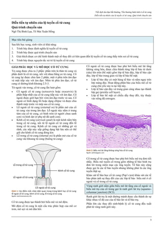Tiết dịch âm đạo bất thường. Tổn thương lành tính ở cổ tử cung
Diễn tiến tự nhiên của lộ tuyến cổ tử cung. Quá trình chuyển sản
1
Diễn tiến tự nhiên của lộ tuyến cổ tử cung
Quá trình chuyển sản
Ngô Thị Bình Lụa, Tô Mai Xuân Hồng
Mục tiêu bài giảng
Sau khi học xong, sinh viên có khả năng:
1. Trình bày được định nghĩa lộ tuyến cổ tử cung
2. Trình bày được quá trình chuyển sản
3. Giải thích được cơ chế hình thành một số thay đổi có liên quan đến lộ tuyến cổ tử cung thấy trên soi cổ tử cung
4. Trình bày được nguyên tắc xử trí lộ tuyến cổ tử cung
GIẢI PHẪU HỌC VÀ MÔ HỌC CỔ TỬ CUNG
Tử cung được chia ra 2 phần: phần trên là thân tử cung và
phần dưới là cổ tử cung, nối với nhau bằng eo tử cung. Cổ
tử cung lại được chia làm 2 phần, một ở phía trên âm đạo
và một tiếp xúc với âm đạo. Nhìn từ phía âm đạo, cổ tử
cung có đường kính khoảng 2.5-3.
Từ ngoài vào trong, cổ tử cung lần lượt gồm:
 Cổ ngoài cổ tử cung (ectocervix hoặc exocervix) là
phần thấp nhất của cổ tử cung tiếp xúc với âm đạo. Cổ
ngoài được giới hạn bởi vòm âm đạo trước và sau. Cổ
ngoài có hình dạng lồi hoặc dạng ellipse và được chia
thành mép trước và mép sau cổ tử cung.
 Lỗ ngoài cổ tử cung (external os) là phần mở của cổ
tử cung vào trong âm đạo. Lỗ ngoài này nằm ở trung
tâm của cổ tử cung, có hình tròn (ở người chưa sanh
con) và hình dẹt (ở phụ nữ đã sanh con).
 Kênh cổ tử cung (cervical canal) là một kênh nằm bên
trong cổ tử cung, nối từ lỗ ngoài cổ tử cung đến lỗ
trong cổ tử cung. Kênh cổ tử cung có những gờ và
rãnh, các nếp này xếp giống dạng bật lửa nên có thể
giữ cho kênh cổ tử cung đóng kín.
 Lỗ trong cổ tử cung (internal os) là phần mở của cổ tử
cung vào khoang tử cung (buồng tử cung).
Hình 1: Các điểm mốc nhận diện quan trọng trong bệnh học cổ tử cung:
lỗ ngoài cổ tử cung, kênh cổ tử cung, lỗ trong cổ tử cung
Nguồn: teachmeanatomy.info
Cổ tử cung được tạo thành bởi biểu mô và mô đệm.
Mô đệm cổ tử cung là một cấu trúc phức hợp của mô cơ
trơn, mô sợi và mô đàn hồi.
Cổ ngoài cổ tử cung được bao phủ bởi biểu mô lát tầng
không sừng hóa, được chia thành từng lớp tế bào từ dưới
(sâu) lên trên (bề mặt) gồm lớp tế bào đáy, lớp tế bào cận
đáy, lớp tế bào trung gian và lớp tế bào bề mặt.
 Lớp tế bào đáy có một hàng tế bào và nằm ngay trên
lớp màng đáy. Hoạt động phân bào của biểu mô cổ tử
cung chủ yếu xảy ra tại lớp này.
 Lớp tế bào cận đáy và trung gian cùng nhau tạo thành
lớp gai (prickle cell layer).
 Lớp tế bào bề mặt có chiều dầy thay đổi, tùy thuộc
vào nồng độ estrogen.
Hình 2: Biểu mô lát tầng không sừng hóa cổ tử cung
Nguồn: pathologypics.com
Cổ trong cổ tử cung được bao phủ bởi biểu mô trụ đơn tiết
nhầy. Biểu mô tuyến cổ trong gồm những tế bào hình trụ
đơn lót trong niêm mạc các ống tuyến. Tế bào này cũng
được gọi là các tế bào tuyến nhưng không phải là các ống
tuyến thật sự.
Khảo sát tế bào học cổ tử cung (Pap’s test) khảo sát các tế
bào phản ảnh sự thay đổi của các lớp tế bào biểu mô ở cổ
ngoài và cổ trong cổ tử cung.
Vùng ranh giới nằm giữa biểu mô lát tầng của cổ ngoài và
biểu mô trụ của cổ trong gọi là ranh giới lát trụ (squamo-
columnar junction) (SCJ).
Ranh giới lát trụ là một đường mảnh được cấu thành do sự
khác nhau về độ cao của tế bào lát và tế bào trụ.
Phần lớn các thay đổi sinh-bệnh lý cổ tử cung đều xuất
phát từ vùng ranh giới này.
 