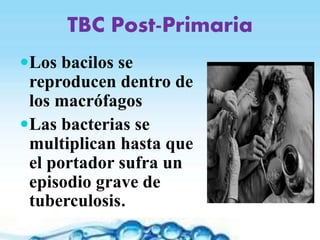 TBC Post-Primaria
Los bacilos se
reproducen dentro de
los macrófagos
Las bacterias se
multiplican hasta que
el portador sufra un
episodio grave de
tuberculosis.
 