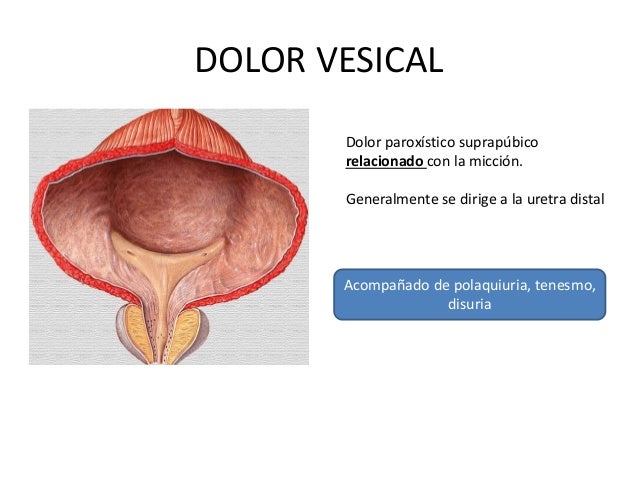 Síntomas del sistema genitourinario Síntomas del sistema genitourinario