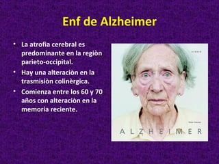Enf de Alzheimer
• La atrofia cerebral es
  predominante en la regiòn
  parieto-occipital.
• Hay una alteraciòn en la
  trasmisiòn colinèrgica.
• Comienza entre los 60 y 70
  años con alteraciòn en la
  memoria reciente.
 