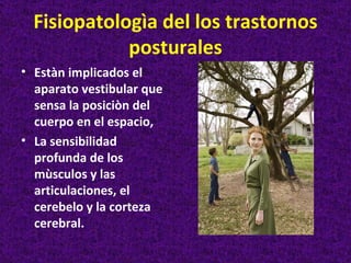 Fisiopatologìa del los trastornos
             posturales
• Estàn implicados el
  aparato vestibular que
  sensa la posiciòn del
  cuerpo en el espacio,
• La sensibilidad
  profunda de los
  mùsculos y las
  articulaciones, el
  cerebelo y la corteza
  cerebral.
 