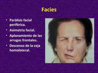 Facies
• Paràlisis facial
  perifèrica.
• Asimetrìa facial.
• Aplanamiento de las
  arrugas frontales.
• Descenso de la ceja
  homolateral.
 