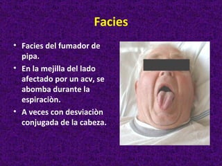 Facies
• Facies del fumador de
  pipa.
• En la mejilla del lado
  afectado por un acv, se
  abomba durante la
  espiraciòn.
• A veces con desviaciòn
  conjugada de la cabeza.
 