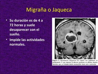 Migraña o Jaqueca
• Su duraciòn es de 4 a
  72 horas y suele
  desaparecer con el
  sueño.
• Impide las actividades
  normales.
 
