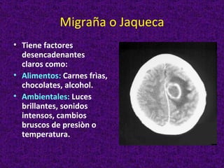 Migraña o Jaqueca
• Tiene factores
  desencadenantes
  claros como:
• Alimentos: Carnes frìas,
  chocolates, alcohol.
• Ambientales: Luces
  brillantes, sonidos
  intensos, cambios
  bruscos de presiòn o
  temperatura.
 
