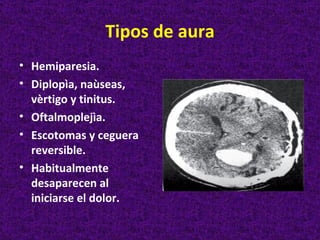 Tipos de aura
• Hemiparesia.
• Diplopìa, naùseas,
  vèrtigo y tinitus.
• Oftalmoplejìa.
• Escotomas y ceguera
  reversible.
• Habitualmente
  desaparecen al
  iniciarse el dolor.
 