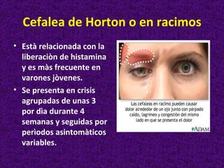 Cefalea de Horton o en racimos
• Està relacionada con la
  liberaciòn de histamina
  y es màs frecuente en
  varones jòvenes.
• Se presenta en crisis
  agrupadas de unas 3
  por dìa durante 4
  semanas y seguidas por
  perìodos asintomàticos
  variables.
 