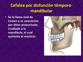 Cefalea por disfunciòn tèmporo-
              mandibular
• Se le llama sind de
  Costen y se caracteriza
  por dolor preauricular,
  irradiado a la
  mandìbula, el cual
  aumenta al masticar.
 