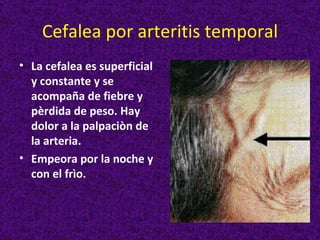 Cefalea por arteritis temporal
• La cefalea es superficial
  y constante y se
  acompaña de fiebre y
  pèrdida de peso. Hay
  dolor a la palpaciòn de
  la arteria.
• Empeora por la noche y
  con el frìo.
 