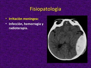 Fisiopatologìa
• Irritaciòn menìngea:
• Infecciòn, hemorragia y
  radioterapia.
 