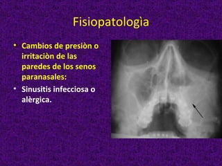 Fisiopatologìa
• Cambios de presiòn o
  irritaciòn de las
  paredes de los senos
  paranasales:
• Sinusitis infecciosa o
  alèrgica.
 