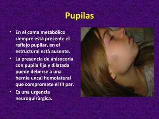 Pupilas
• En el coma metabòlico
  siempre està presente el
  reflejo pupilar, en el
  estructural està ausente.
• La presencia de anisocoria
  con pupila fija y dilatada
  puede deberse a una
  hernia uncal homolateral
  que compromete el III par.
• Es una urgencia
  neuroquirùrgica.
 