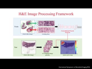 International Symposium on Biomedical Imaging 2016
H&E Image Processing Framework
Train
whole slide image
sample
sample
training data
normaltumor
Test
whole slide image
overlapping image
patches tumor prob. map
1.0
0.0
0.5
Convolutional Neural
Network
P(tumor)
 