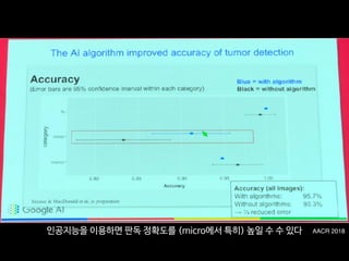 AACR 2018인공지능을 이용하면 판독 정확도를 (micro에서 특히) 높일 수 수 있다
 