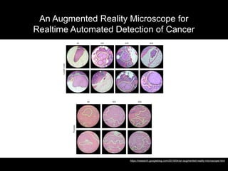  
 
 
 
 
 
Figure 3: Sample views through the lens. 
Top: Lymph node metastasis detection at 4X, 10X, 20X, and 40X. 
Bottom: Prostate cancer detection at 4X, 10X, and 20X. 
An Augmented Reality Microscope for
Realtime Automated Detection of Cancer
https://research.googleblog.com/2018/04/an-augmented-reality-microscope.html
 